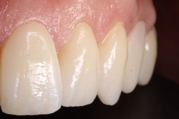 xr:d:DAGCbpfUZYk:31,j:1175864392792683555,t:24041423