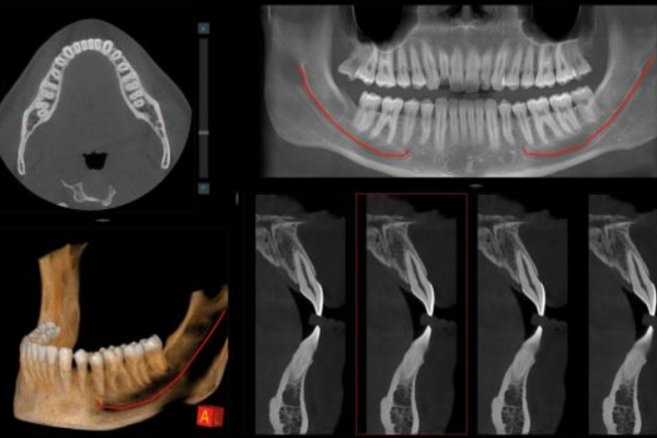 Captura de pantalla 2024-04-26 214519 Captura de pantalla 2024-04-26 214519