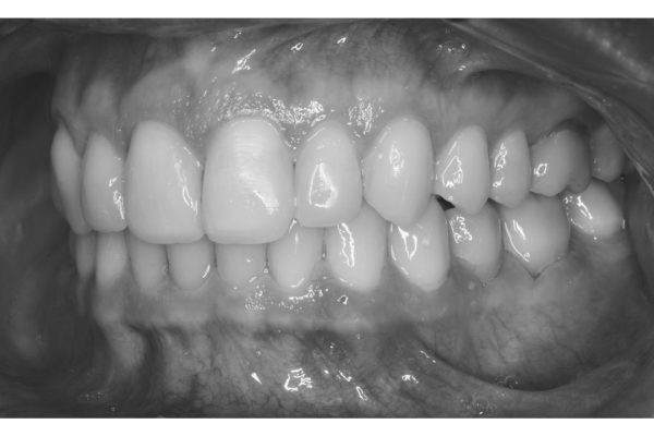 xr:d:DAGCbpfUZYk:33,j:7142008003564106941,t:24041500